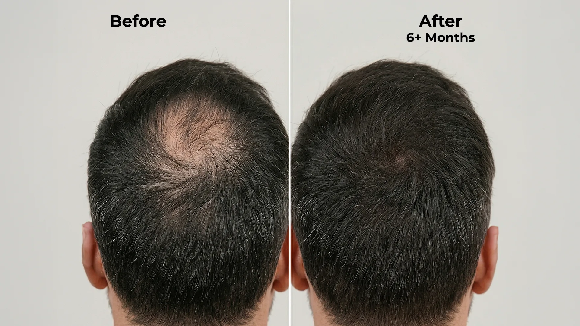 Ghori Derma Roller — Good to Know