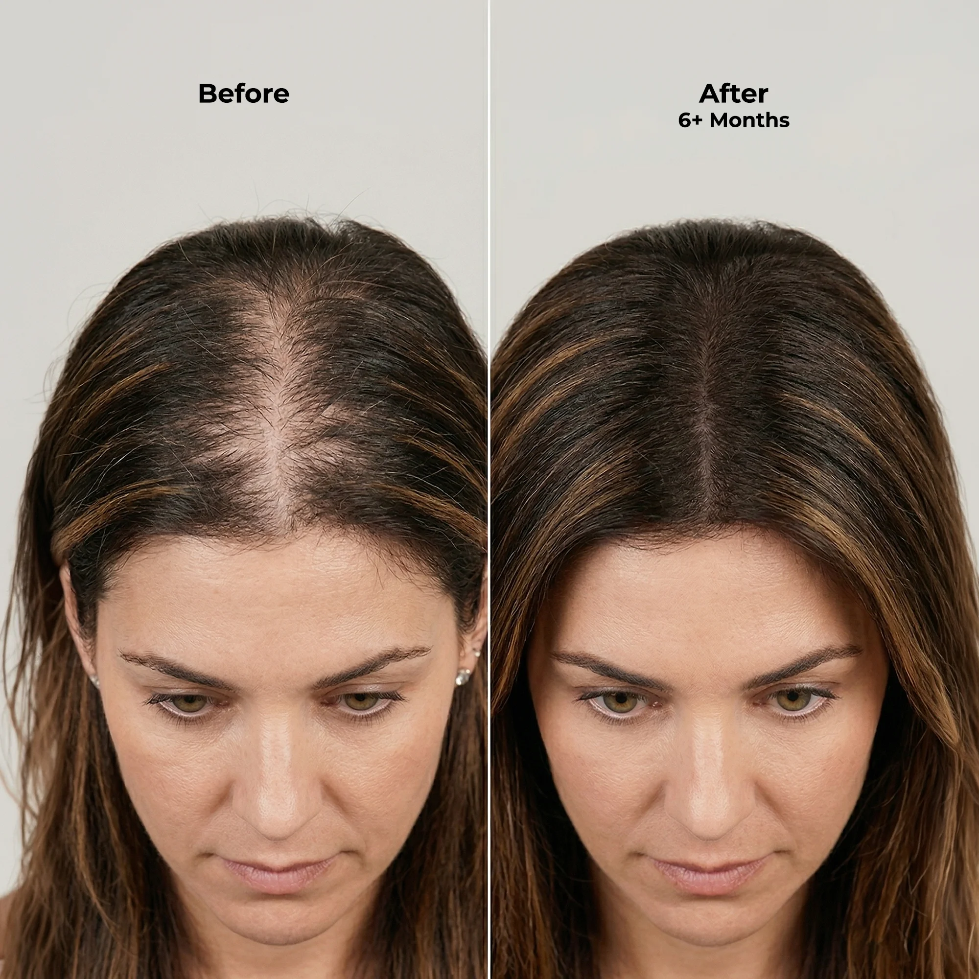 Ghori Derma Roller — view 6